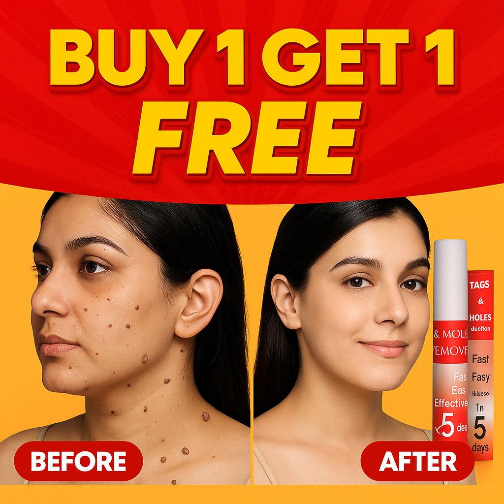LOVILDS™ Warts & Tags Remover Pen - (Buy 1 Get 1 FREE🔥🔥)