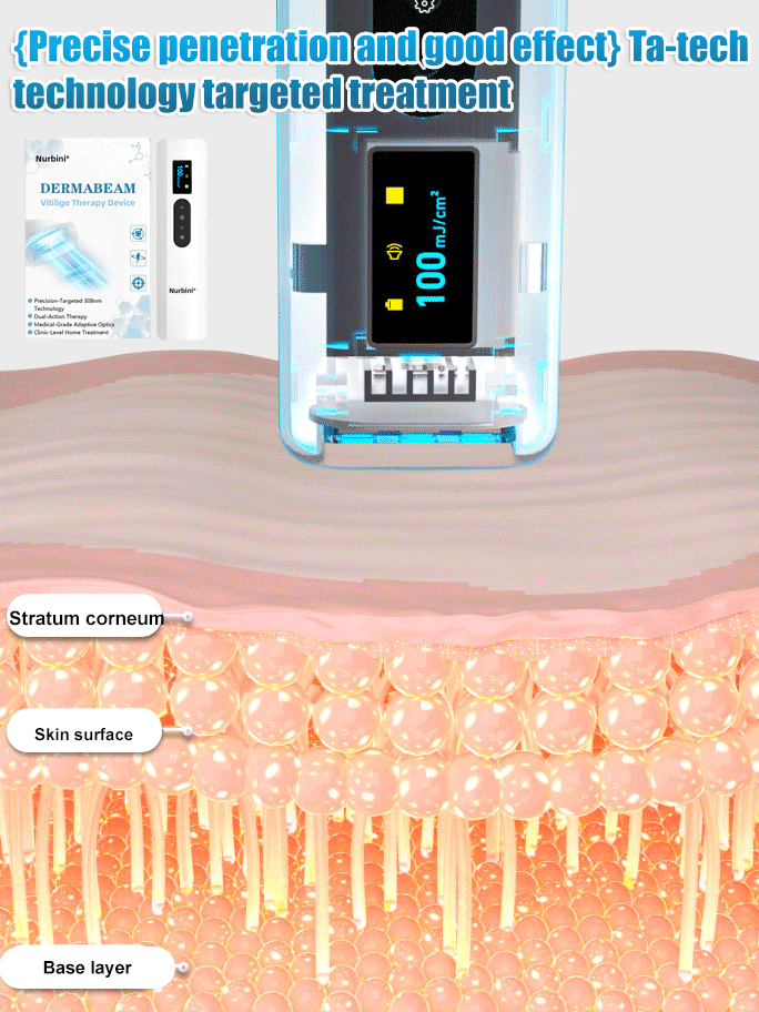 💥Nurbini® DermaBeam Vitiligo Therapy Device⏳Limited-time 48% off⏰💥