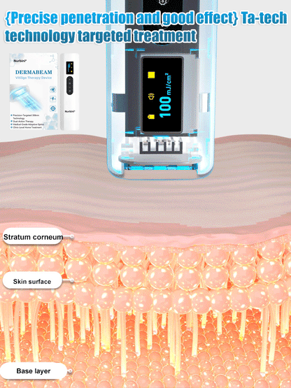 💥Nurbini® DermaBeam Vitiligo Therapy Device⏳Limited-time 48% off⏰💥