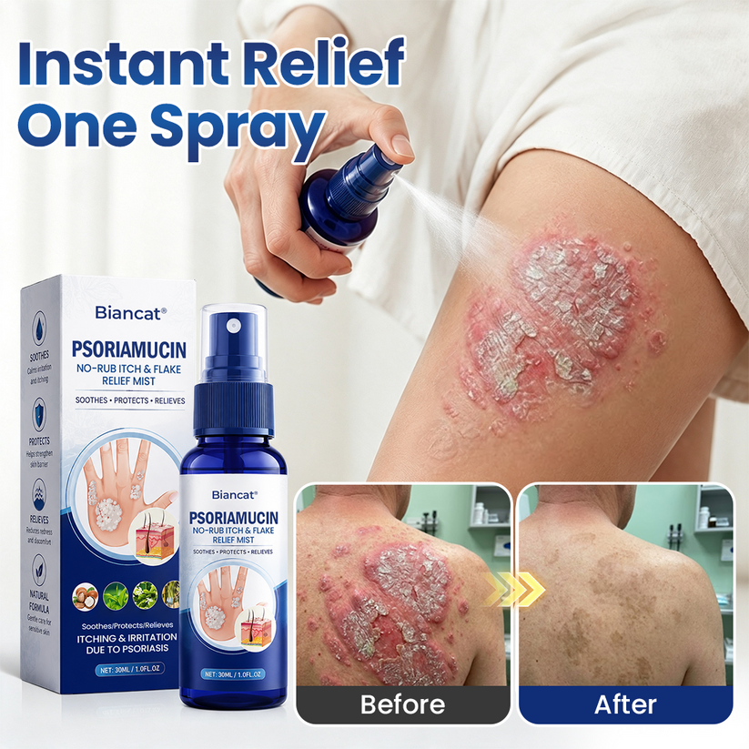⚡⏳Limited-time 48% off⏰💥Biancat® PsoriaMucin No-Rub Itch & Flake Relief Mist