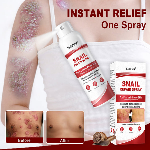 🔥KUBOZN® Snail Repair Spray for Itchy, Flaky Psoriasis Skin🛡️【Imported from the UK】