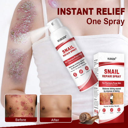 🔥KUBOZN® Snail Repair Spray for Itchy, Flaky Psoriasis Skin🛡️【Imported from the UK】
