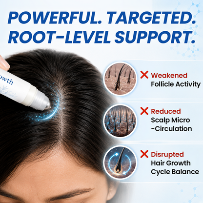 Timilk® Hair Growth Serum Roll-On – 3% Rosemary Oil Scalp Treatment for Thicker, Healthier-Looking Hair | For Men & Women 25ml