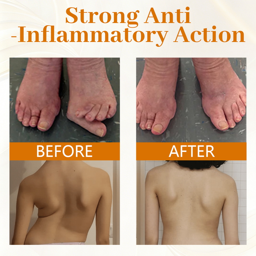 Timilk® ScorpiTakt Joint & Muscle Relief Ointment⏳Limited-time 49% off⏰💥