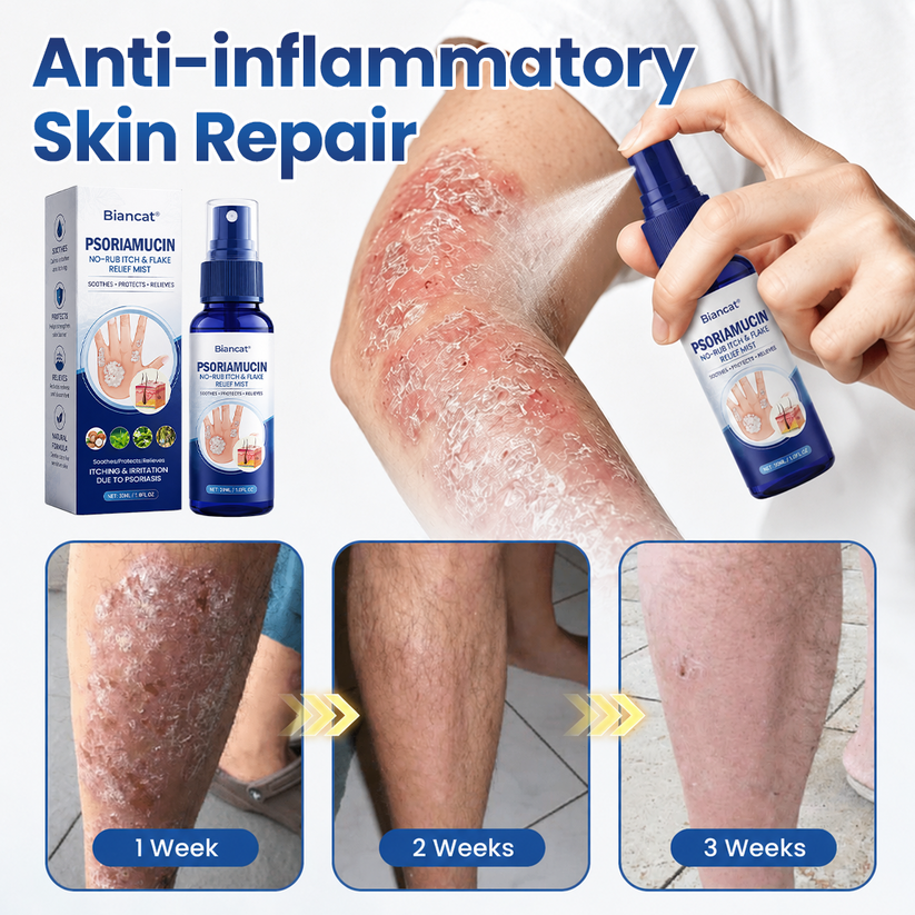 ⚡⏳Limited-time 48% off⏰💥Biancat® PsoriaMucin No-Rub Itch & Flake Relief Mist