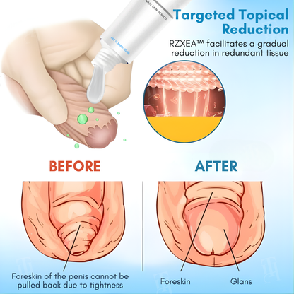 ⚡RZXEA™ Foreskin Elasticity Gel: Restore Your Edge, Restart Your Vitality.【Enough for five people!】