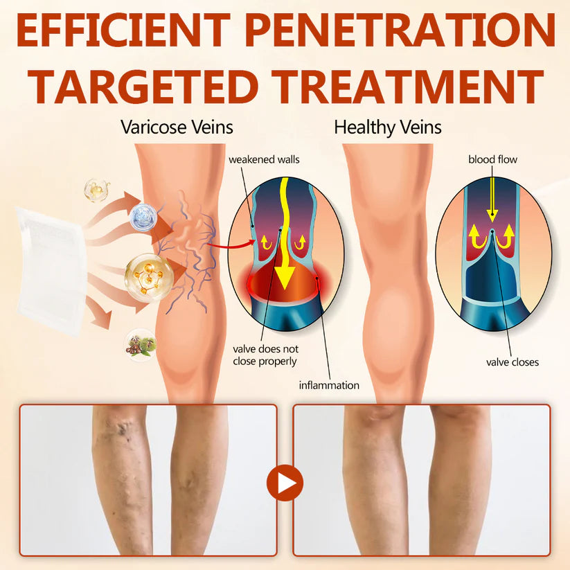 Timilk® VeinRepair Microneedle Patch Roll⚡⏳Limited-time 48% off⏰💥