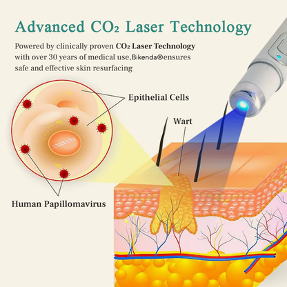 Bikenda® Mole and Wart Instant Removal Laser Pen⏳Limited-time 48% off⏰💥