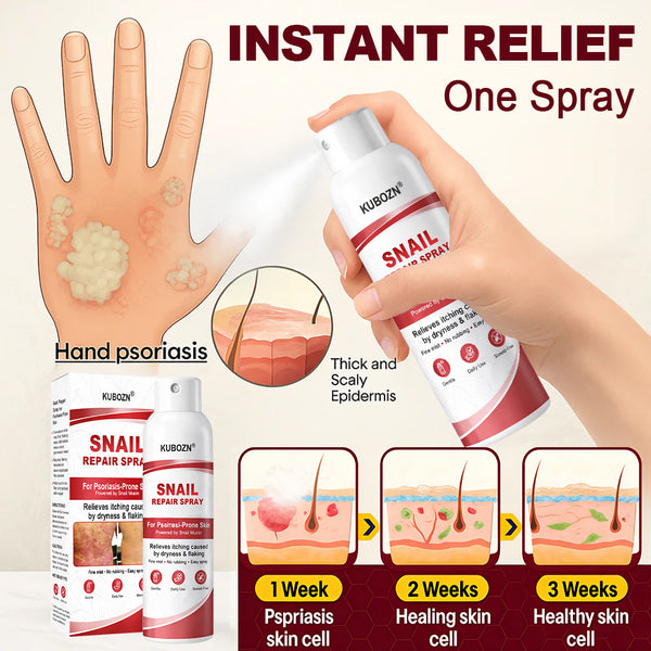 🔥KUBOZN® Snail Repair Spray for Itchy, Flaky Psoriasis Skin🛡️【Imported from the UK】