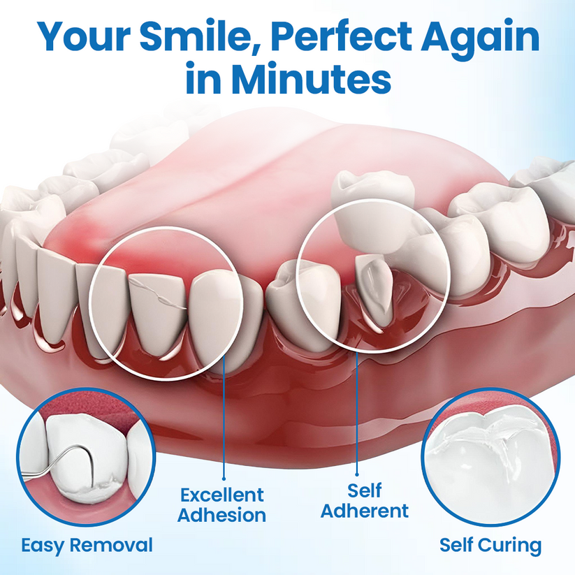 Timilk® SmileMend Tooth Repair Filling Kit⏳Limited-time 48% off⏰💥