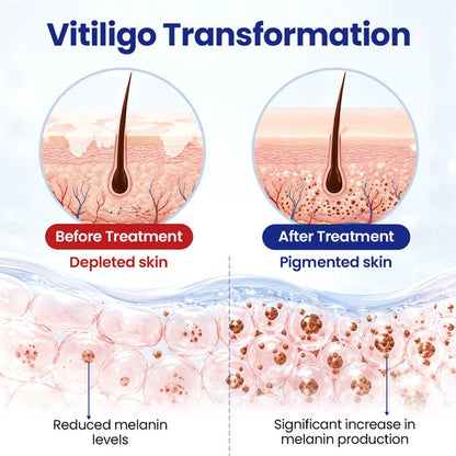 Biancat® VitiRepair Advanced Spray✨ NO MORE VISIBLE WHITE PATCHES — DAY OR NIGHT ✨