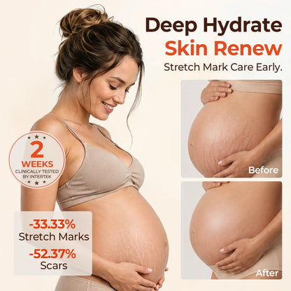 ⚡⏳Limited-time 48% off⏰💥Biancat® SilkStretch Natural Stretch Mark & Scar Oil