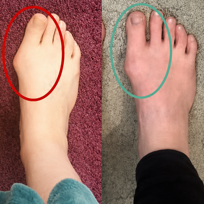 🔥Bikenda® FootAlign EMS Pro —— Advanced EMS Foot Support System🔥