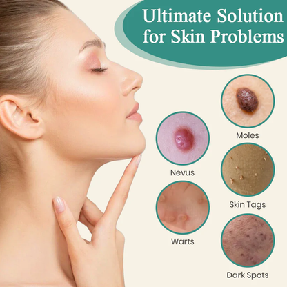 Bikenda® Mole and Wart Instant Removal Laser Pen⏳Limited-time 48% off⏰💥