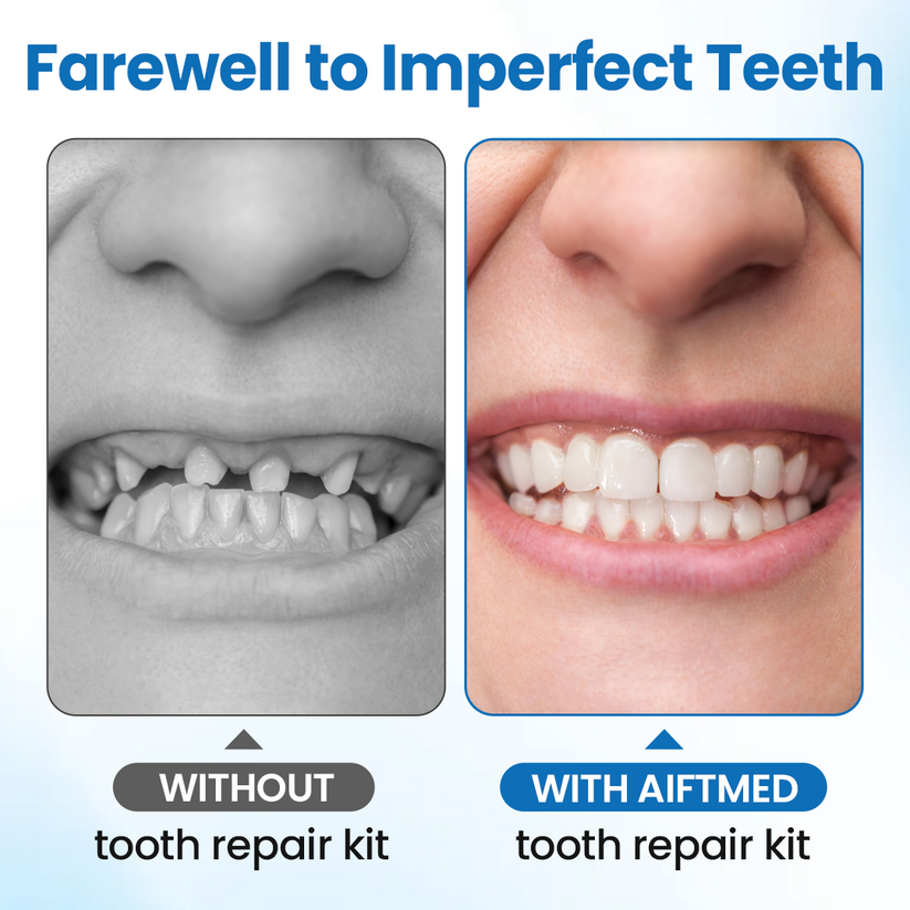 Timilk® SmileMend Tooth Repair Filling Kit⏳Limited-time 48% off⏰💥
