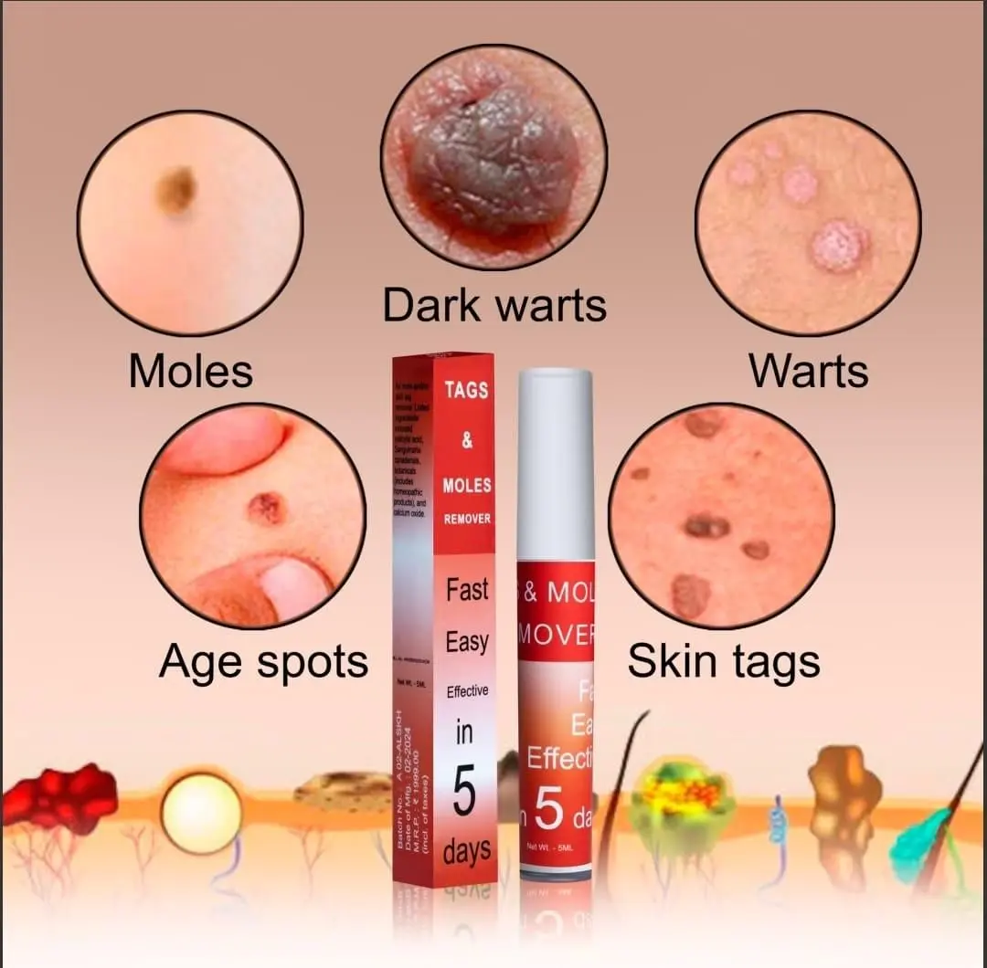 LOVILDS™ Warts & Tags Remover Pen - (Buy 1 Get 1 FREE🔥🔥)